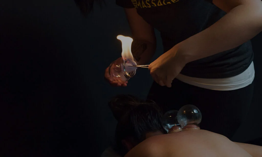 Myofascial cupping massage treatment