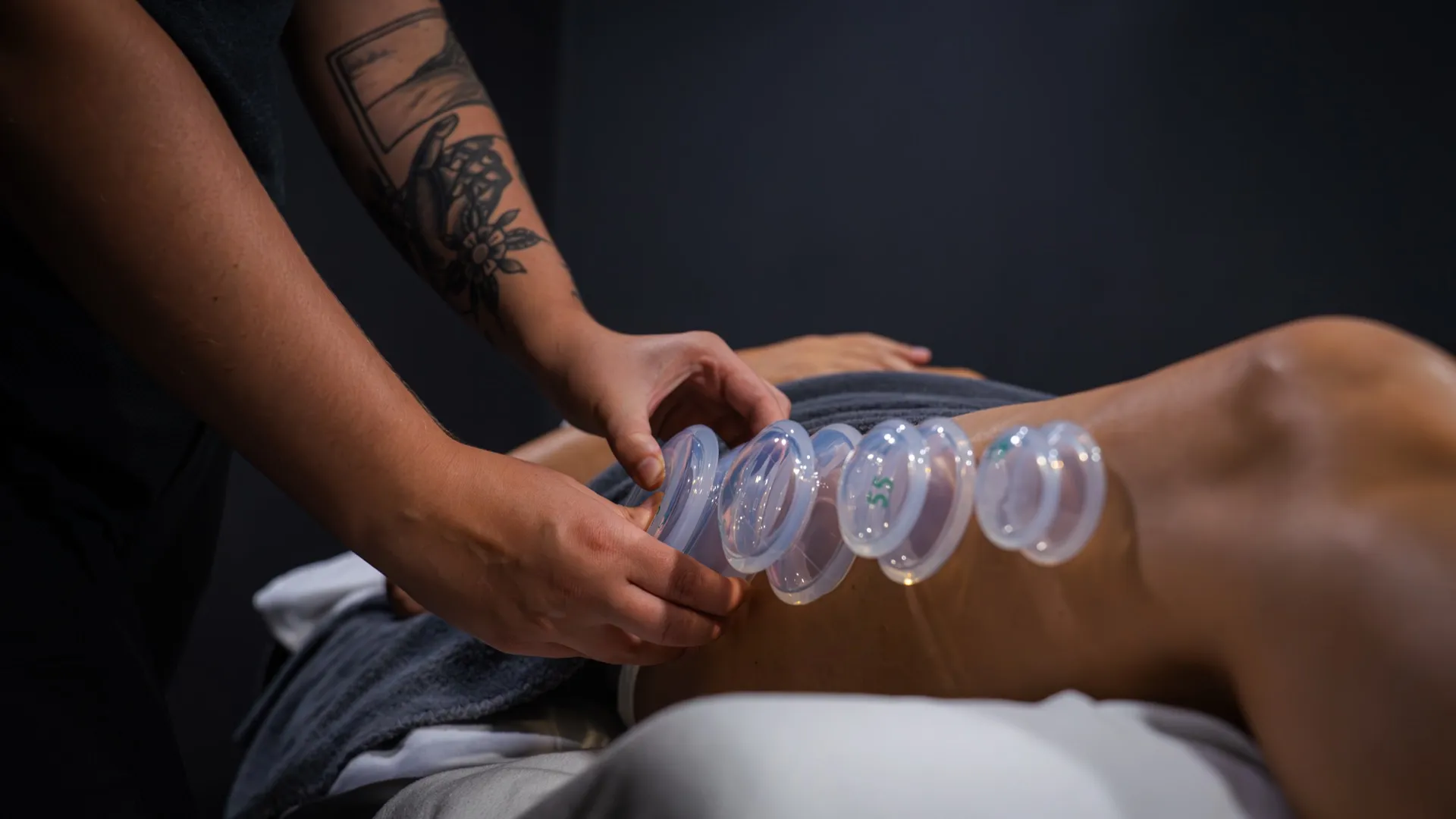 Myofascial Cupping Massage
