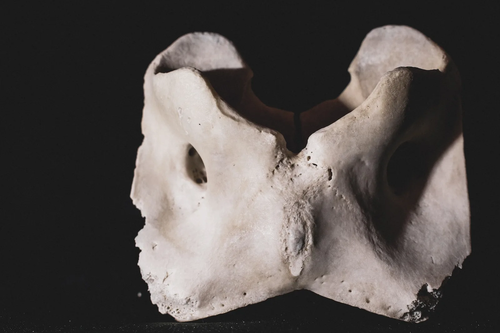 Understanding the Atlas Bone and Its Impact on Mobility