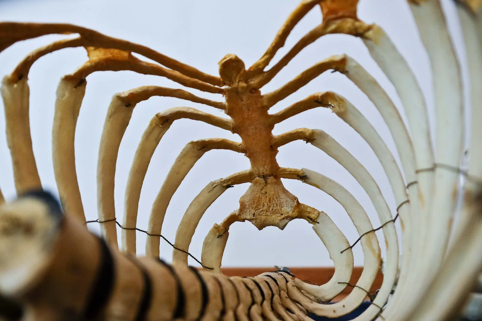 Relieving Rib Cage Muscle Pain: Effective Tips for Recovery