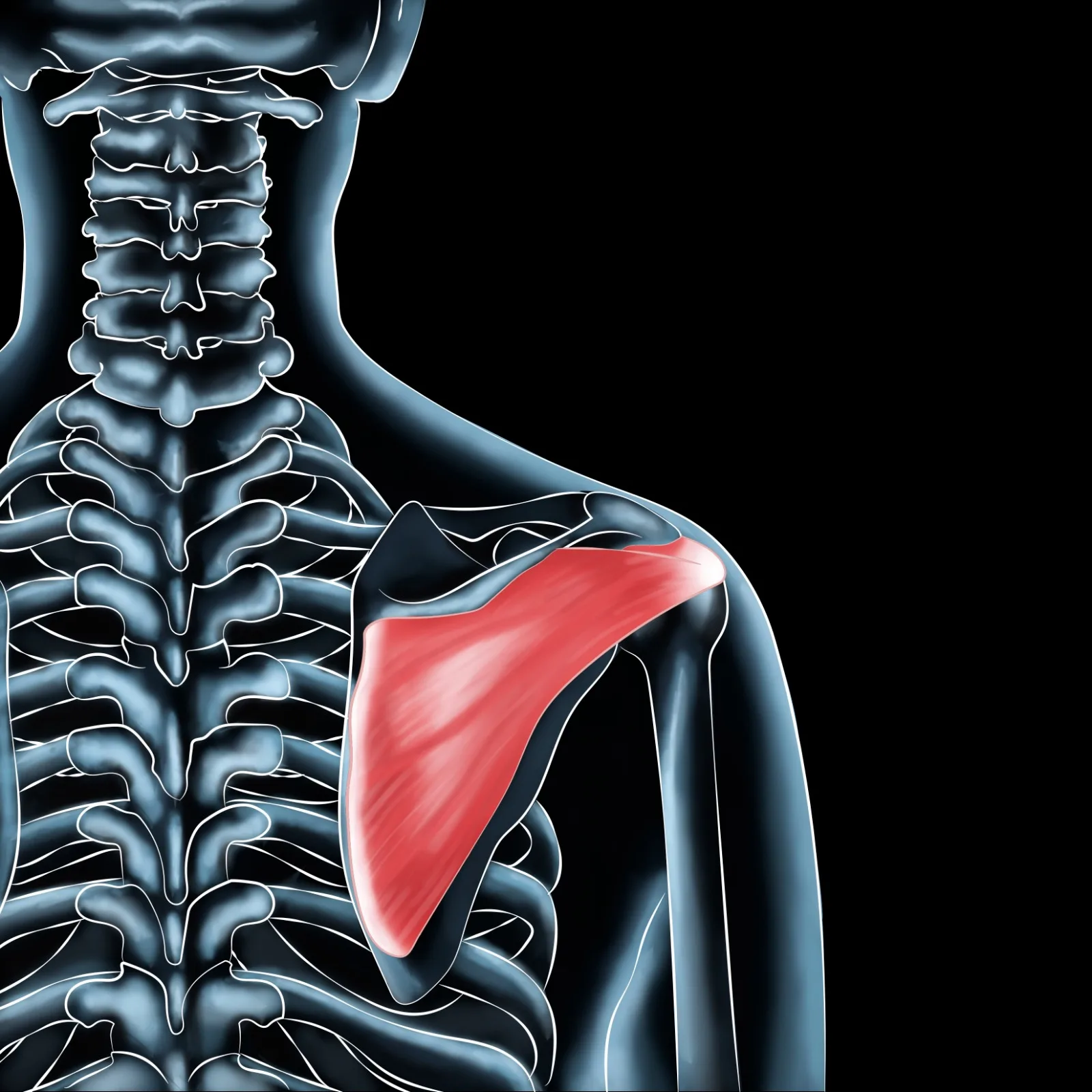 Infraspinatus Muscle Pain? Effective Relief Tips for Active Recovery