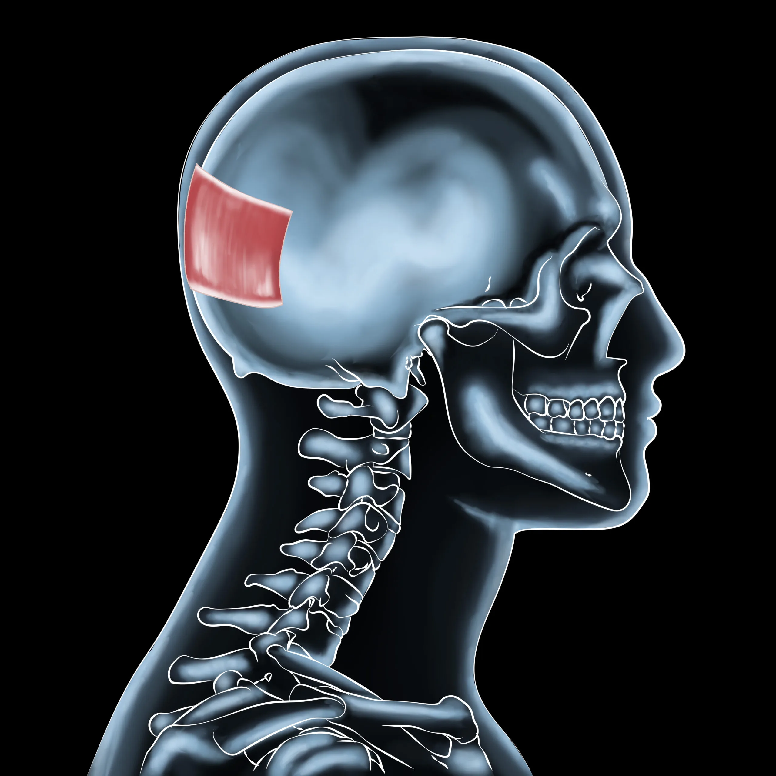 Overcoming Occipitalis Injuries: Effective Treatments for Neck Pain