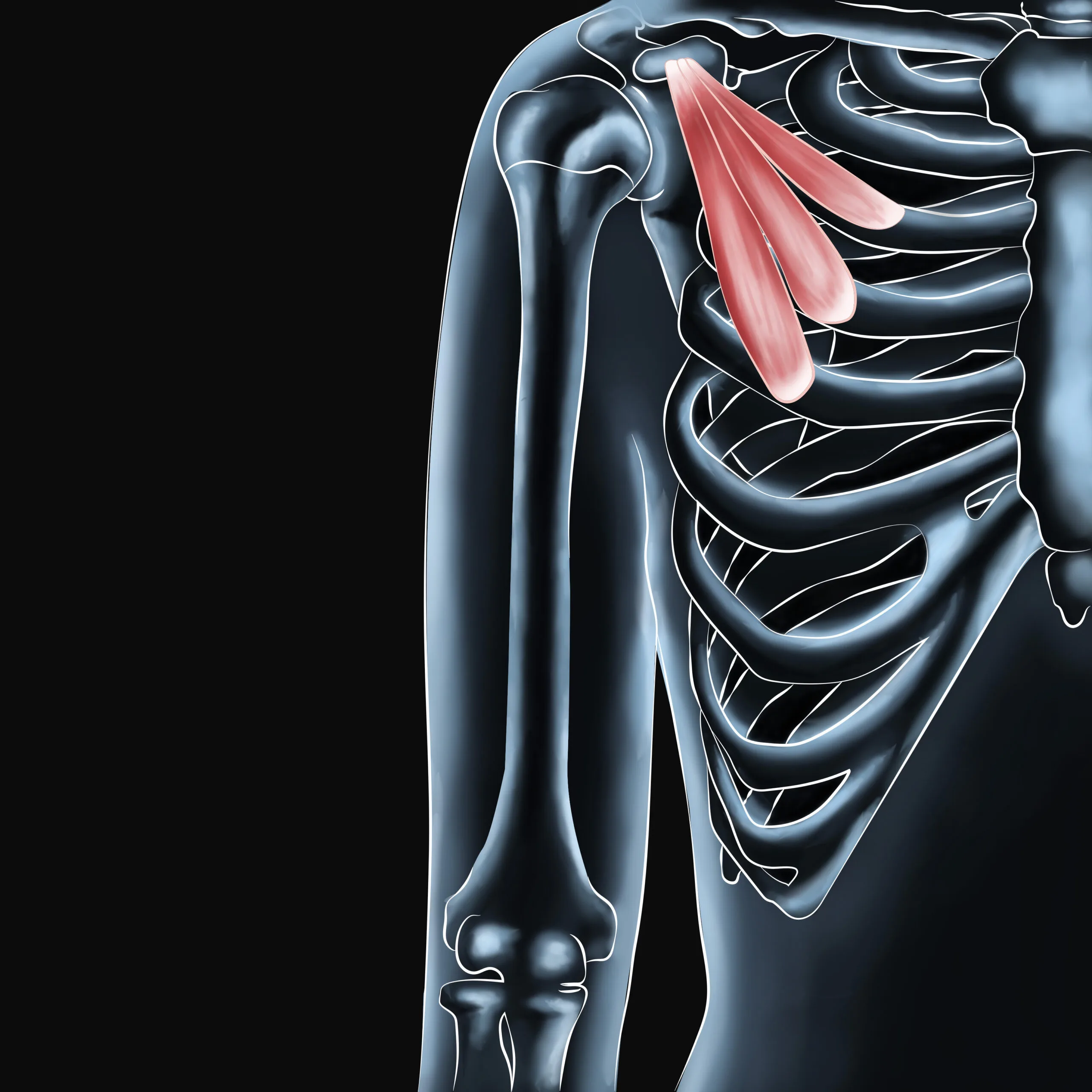 Preventing and Treating Pectoralis Minor Injuries Effectively