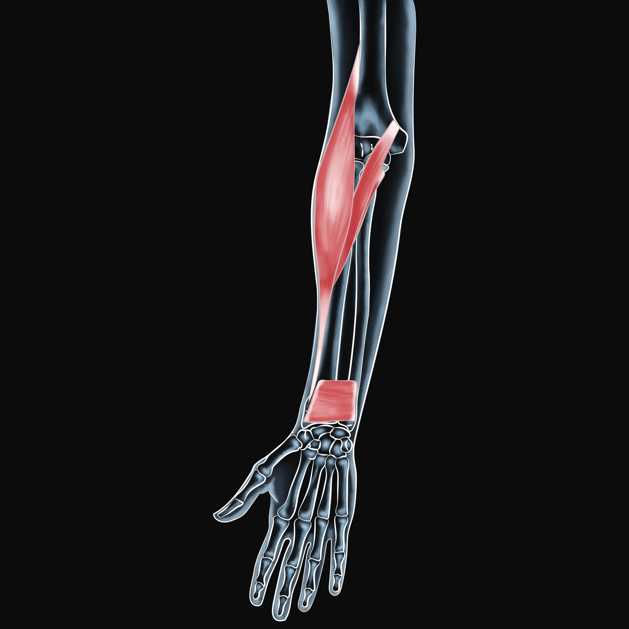 Preventing and Treating Pronator Quadratus Pain