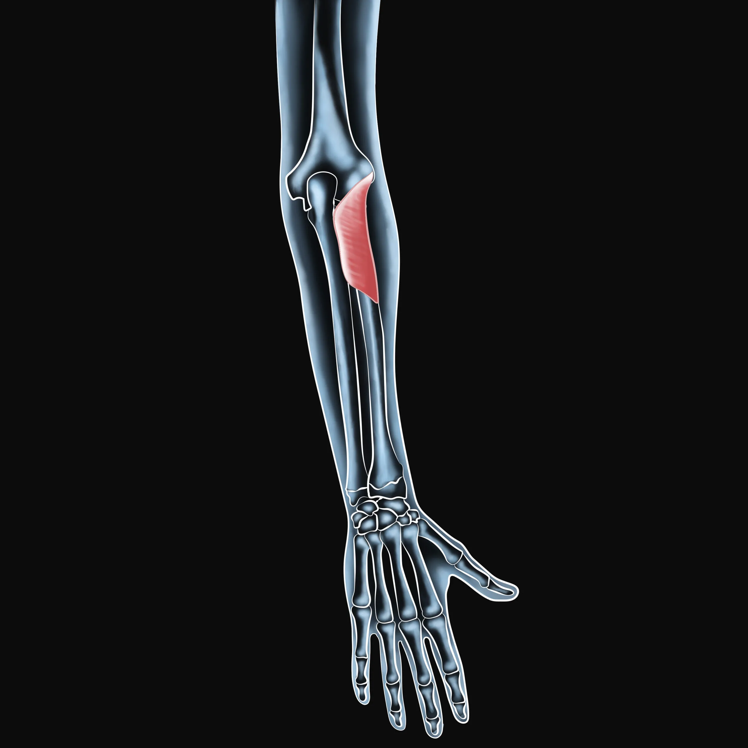 Effective Relief for Supinator Muscle Pain and Injury Recovery