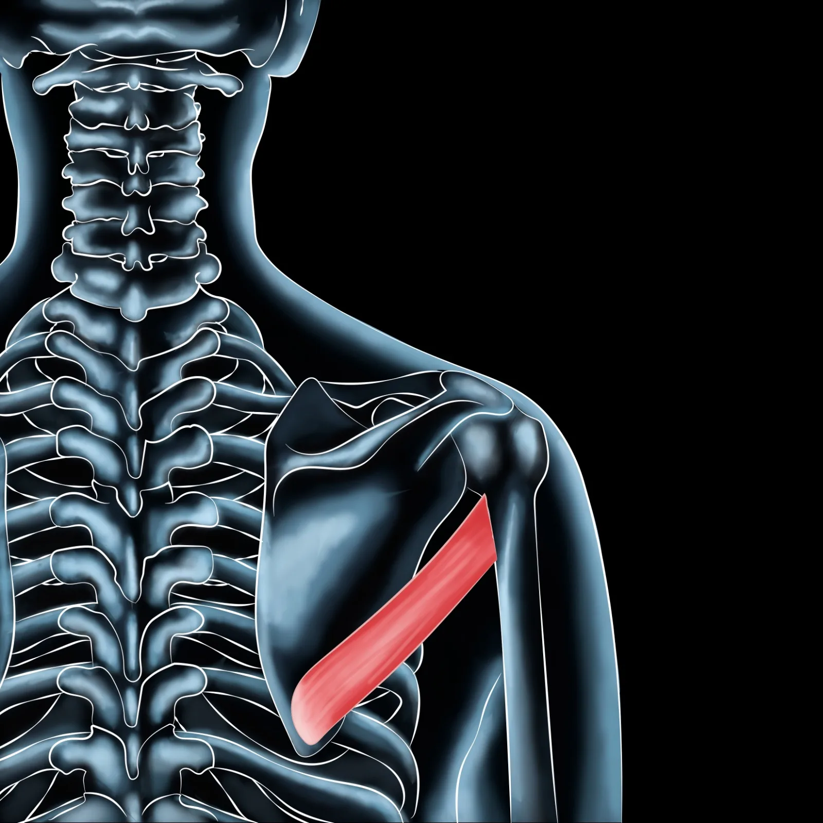 Relieve Teres Major Pain: A Comprehensive Guide for Active Individuals
