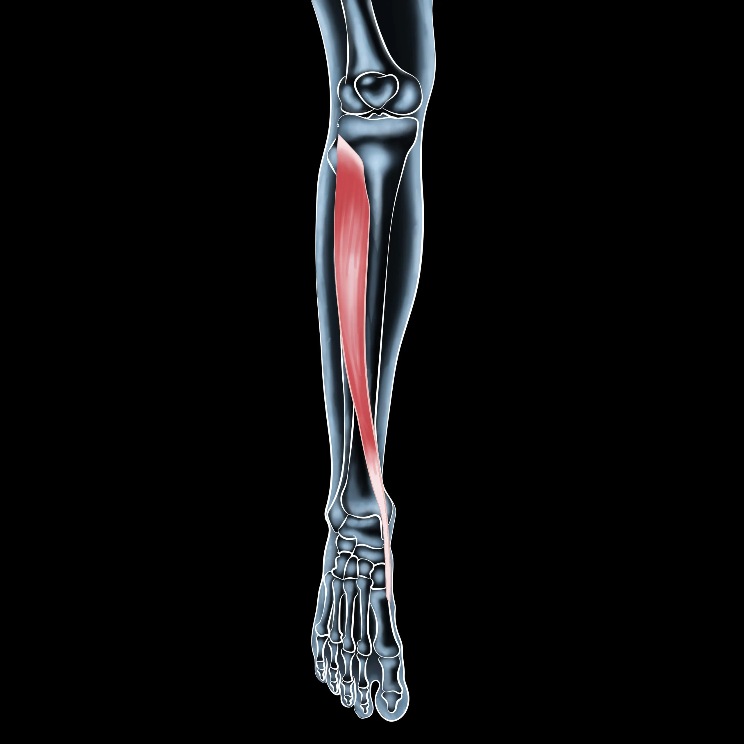 Step Up Your Recovery: Treating Tibialis Anterior Muscle Injuries