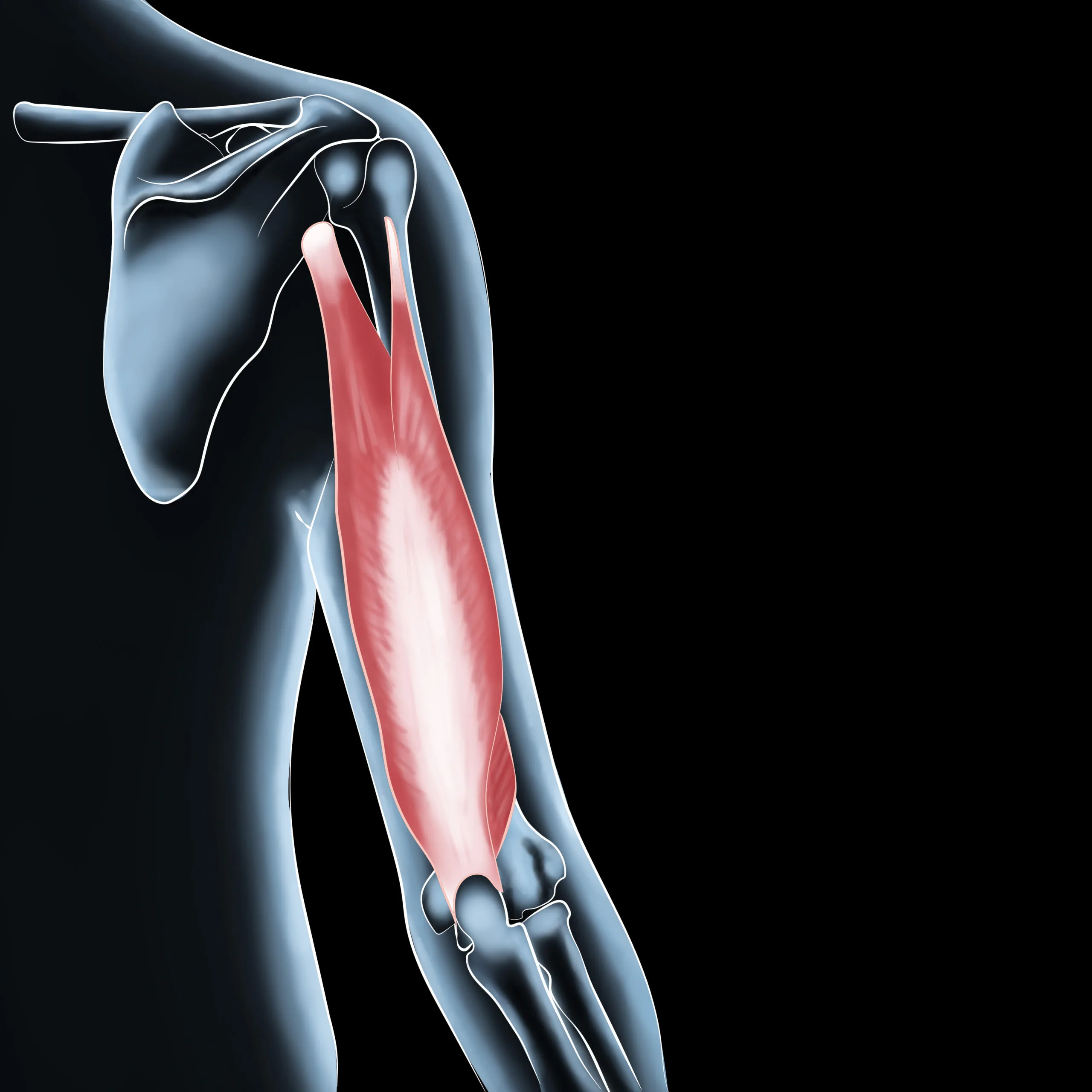 Get Back in the Game: Healing Triceps Brachii Muscle Injuries