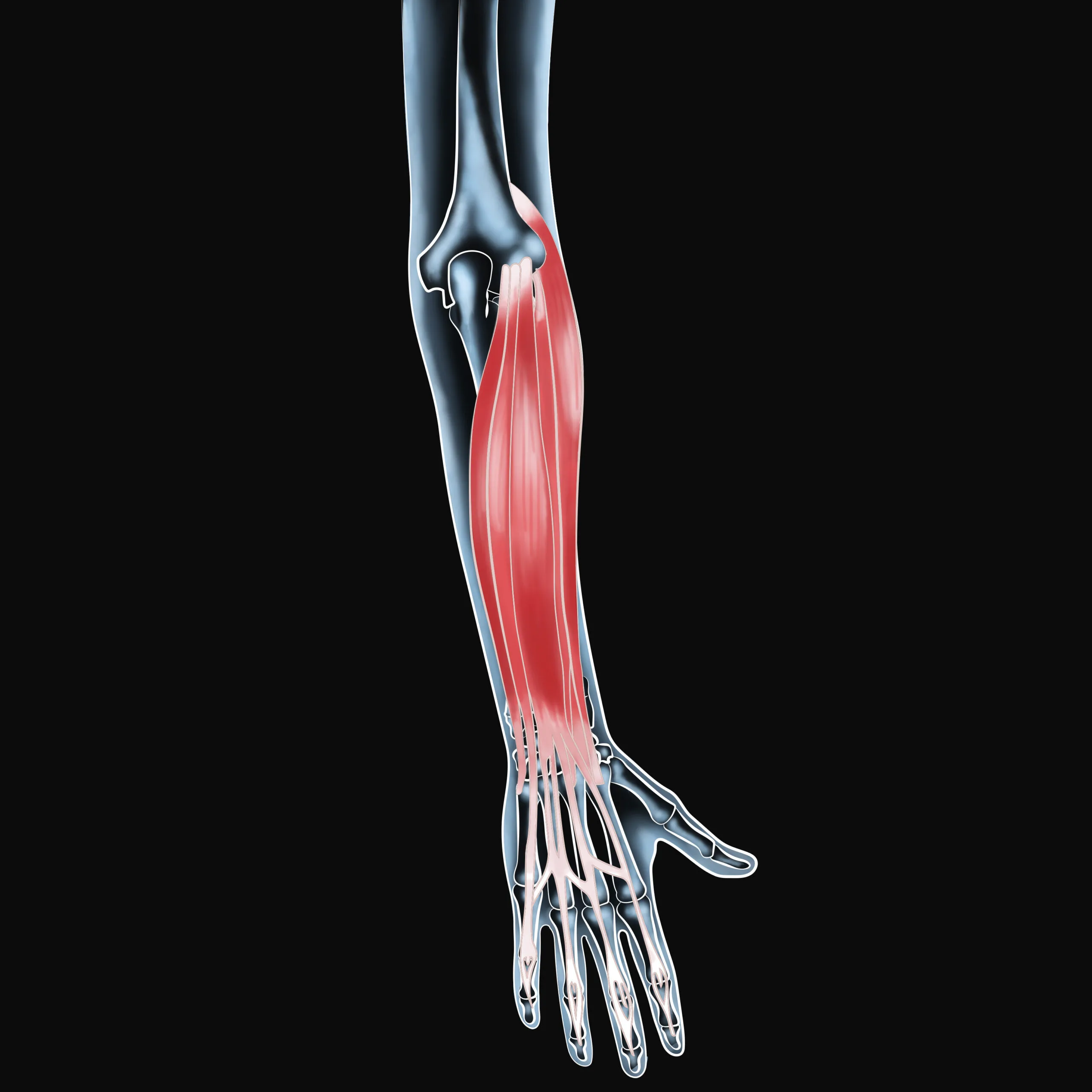 Managing Wrist Extensor Pain for Active Individuals