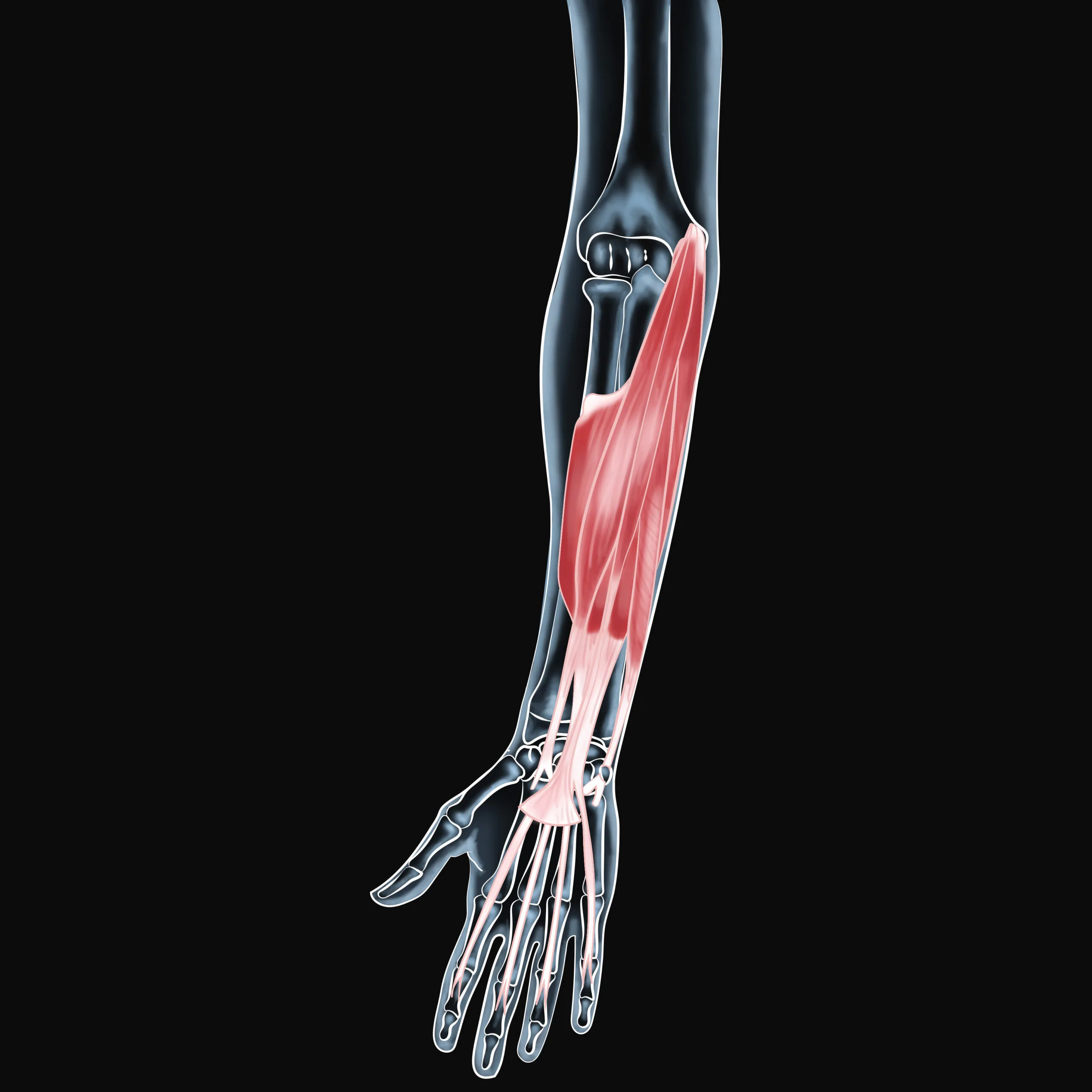 Wrist Flexor Muscle Pain and Recovery Explained