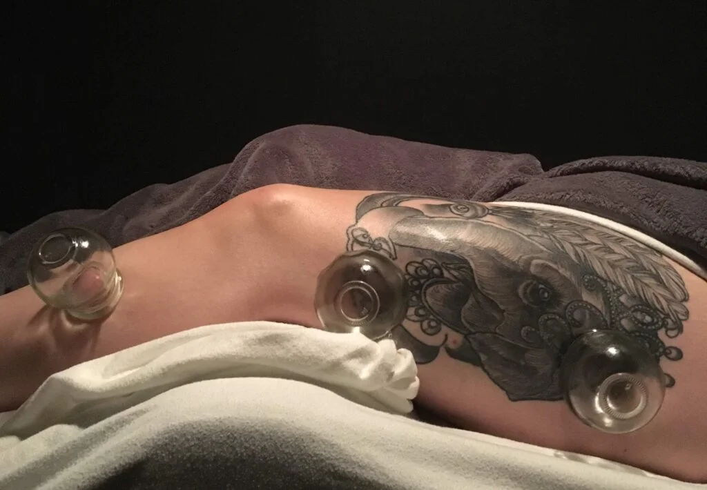 Myofascial Cupping Massage