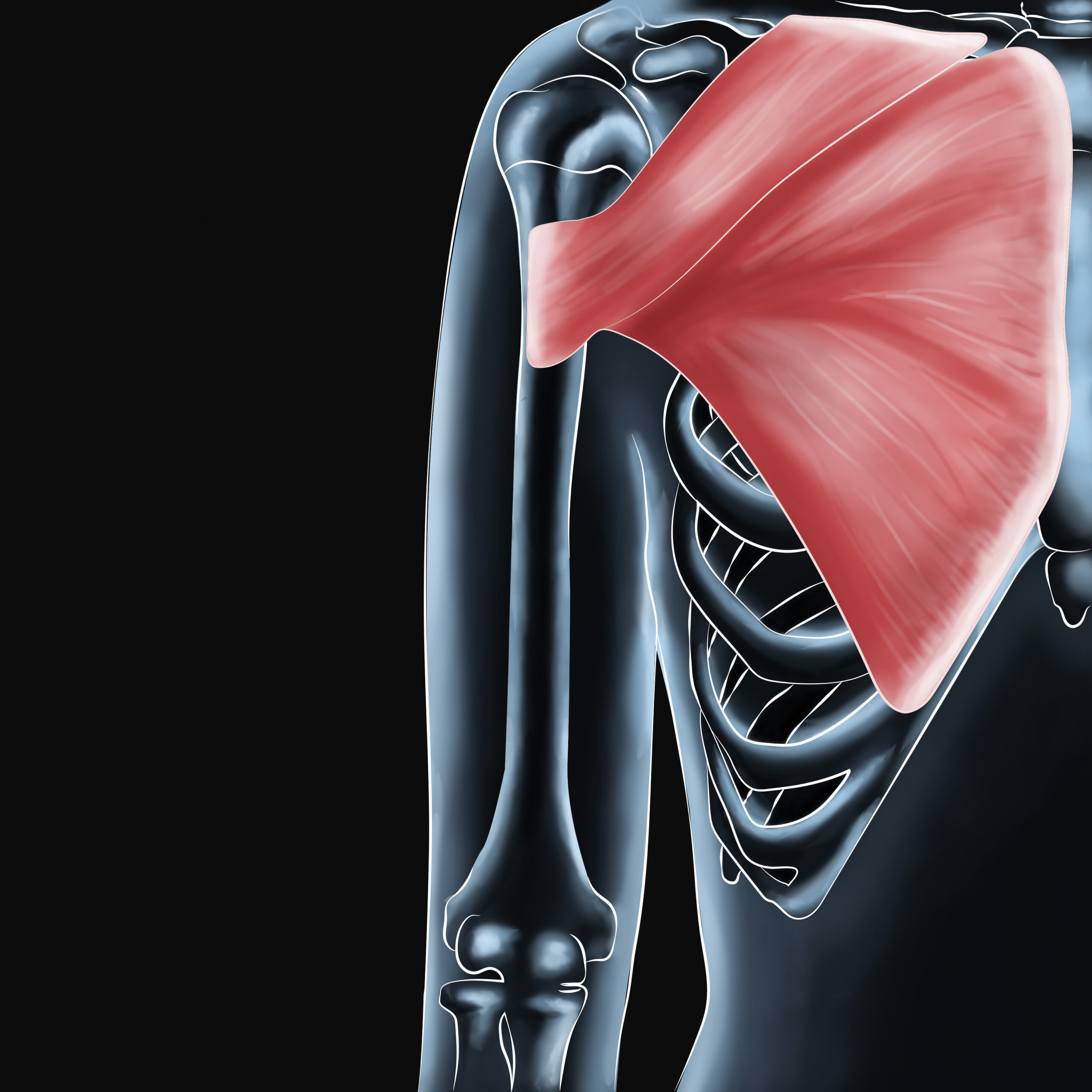 Chest Muscle Injuries: Strains and Tears of the Pectoralis Major - Hughston  Clinic