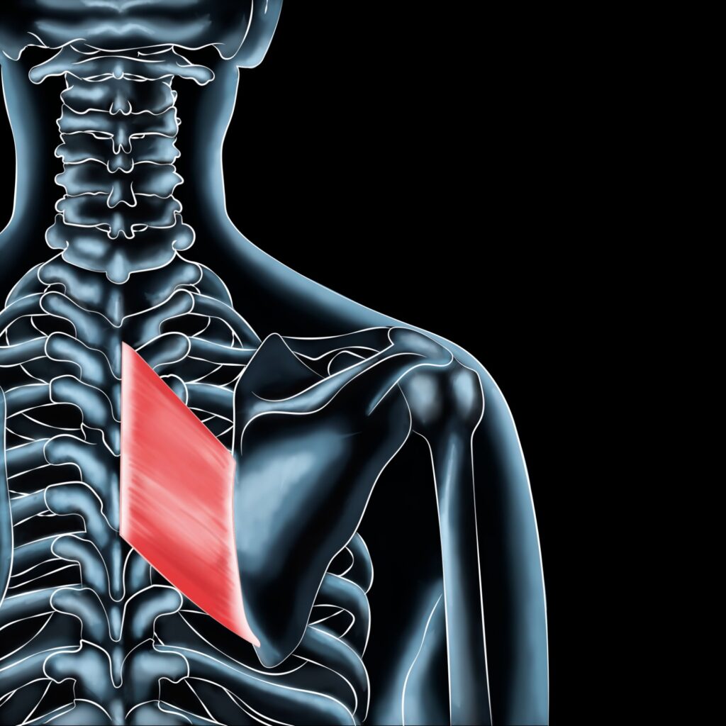 Rhomboid Pain / Interscapular Pain