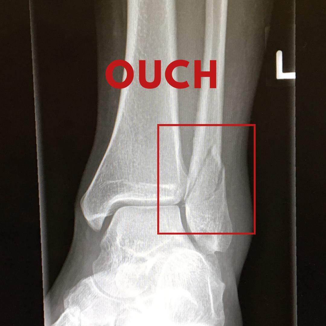 Seeing Inside: What is X-Ray and How Does it Work?