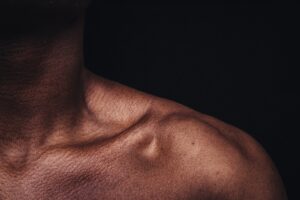 muscle pain under your collarbone