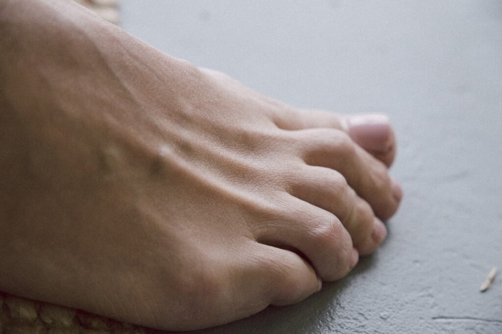 Barefoot Risks: Aggravating Plantar Fasciitis Pain?