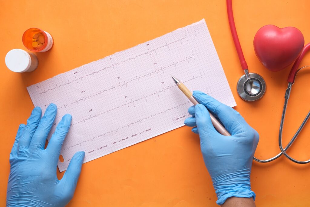 Seeing Your Heart in Action: What is an Echocardiogram?
